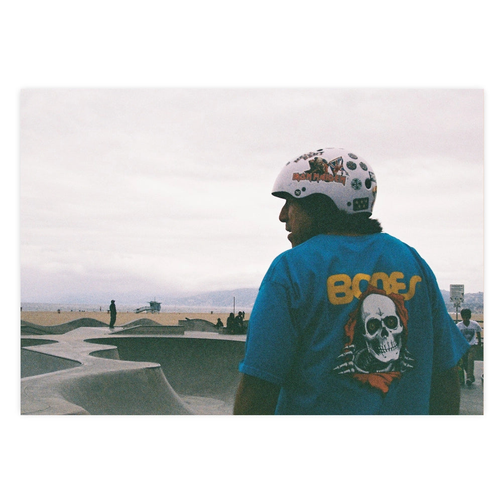 Frame 17, Bones